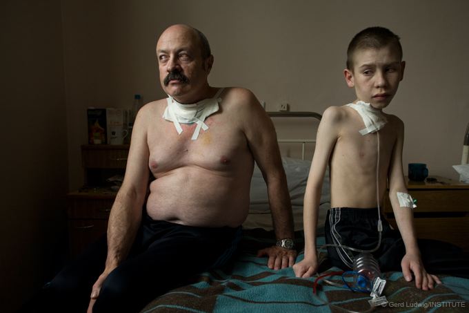 Chernobyl liquidator and young boy after thyroid cancer surgery